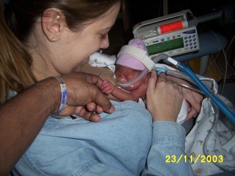 breasfeed on premature baby | Breastfeed Chicago